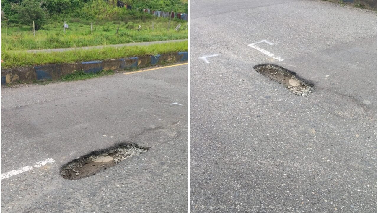 Jalan Rusak Dibiarkan, Mahasiswi Patah Tulang: Pemerintah Tutup Mata atas Lubang Maut di Samabusa?