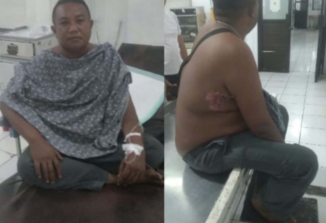 Jurnalis Berinisial SM Alias Samiun Jadi Korban Panah Wayer